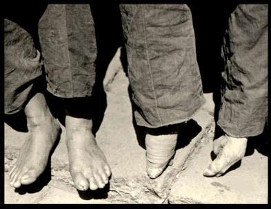 File:11 footbinding.jpg
